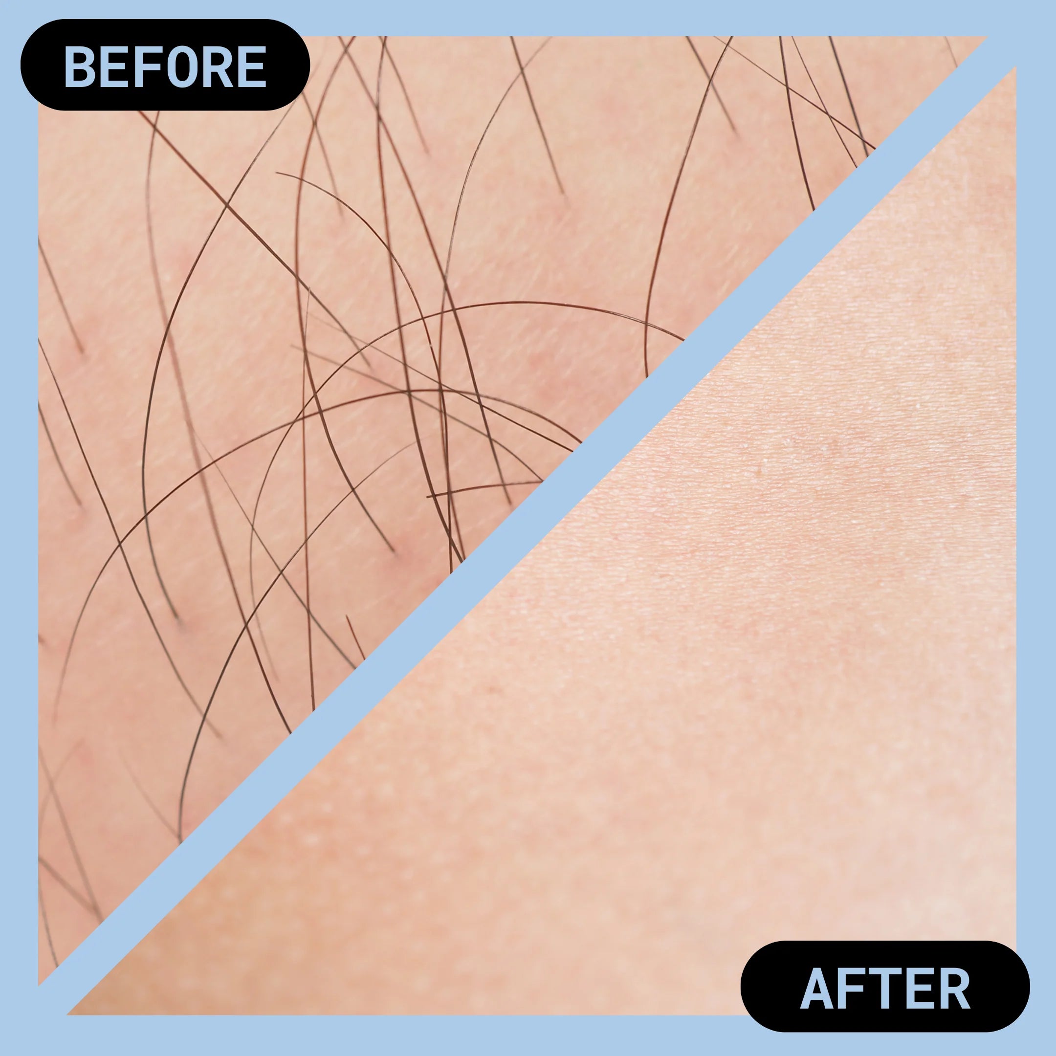 Premium Crystal Hair Remover